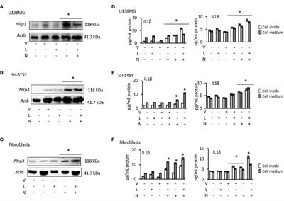 Therapeutic Potential of Pharmacological Targeting NLRP3 Inflammasome Complex in Cancer